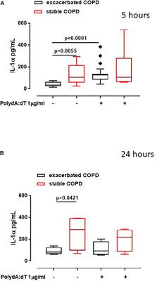 AIM2/IL-1α/TGF-β Axis in PBMCs From Exacerbated Chronic Obstructive Pulmonary Disease (COPD) Patients Is Not Related to COX-2-Dependent Inflammatory Pathway